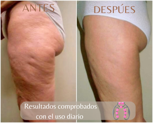 💜 RODILLO MASAJEADOR MANUAL 360° Drena, Relaja y Moldea tu Cuerpo Naturalmente