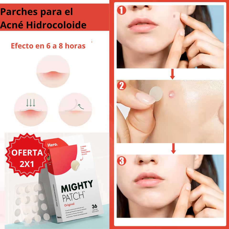 Parches Acné Espinillas Mighty Patch - Reduce imperfecciones y protege tu piel mientras actúa rápido